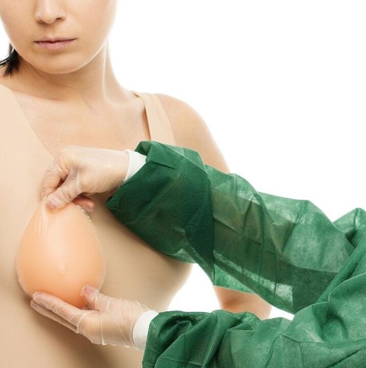 implantati za povećanje grudi